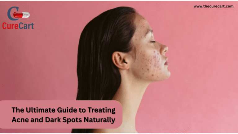 The Ultimate Guide to Treating Acne and Dark Spots Naturally